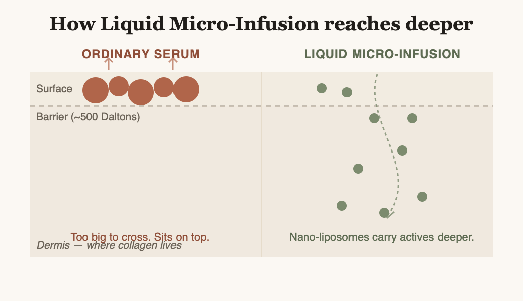 Cross-section of skin showing needle-free micro-infusion reaching deeper than a surface serum
